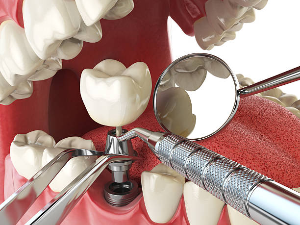 Best Emergency Denture Repair in Westwood, KS